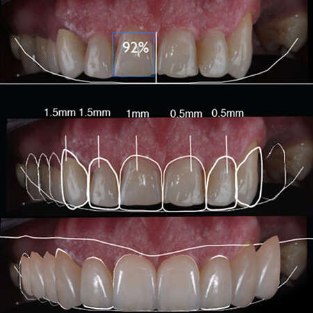 servicios-prostodoncia-img